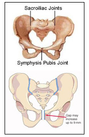 Pregnancy and Pelvic Girdle Pain & Pubic Symphysis Dysfunction